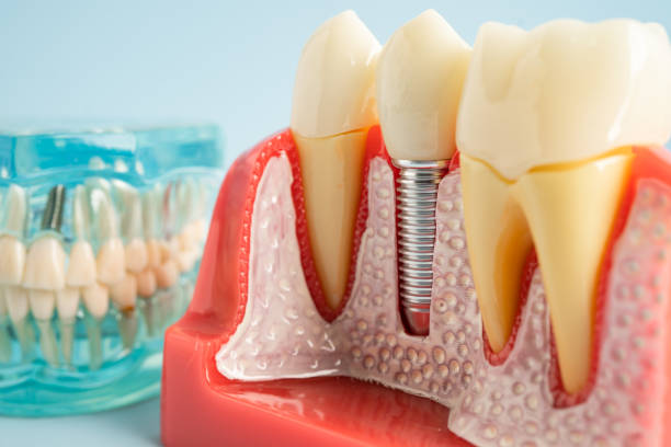 Best Dental Studio in West Palm Beach, FL